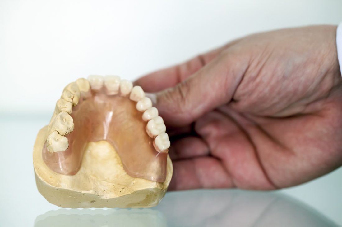 Zirconia and porcelain crown work on a model.